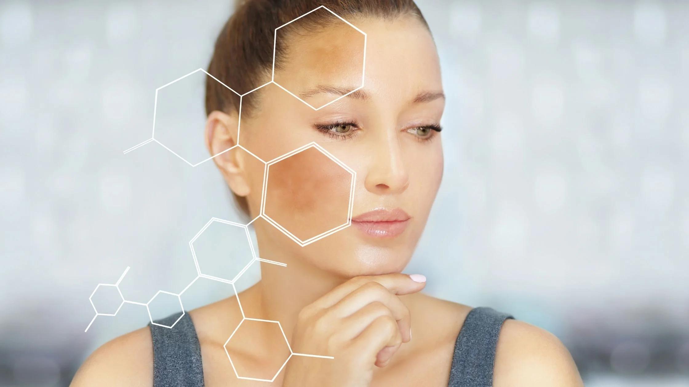 Do you know the three types of Melasma?